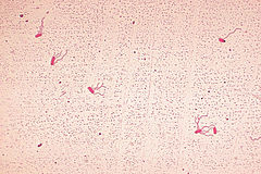 Alcaligenes faecalis PHIL-stained.jpg