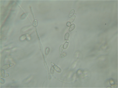 Genicularia spores 160X.png