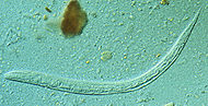 Strongyloides stercoraliz larva.jpg