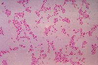 BacteroidesFragilis Gram.jpg