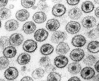 HIV-1 Transmission electron micrograph AIDS02bbb lores.jpg