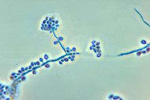 Conidiophores and conidia of the fungus Sporothrix schenckii PHIL 4208 lores.jpg