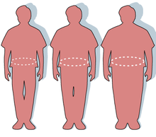 Obesity-waist circumference.PNG