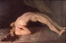 Opisthotonus in a patient suffering from tetanus - Painting by Sir Charles Bell - 1809.jpg