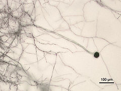 Aspergillus nigar Micrograph.jpg