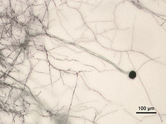 Aspergillus niger Micrograph.jpg