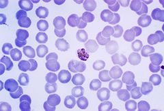 Mature Plasmodium malariae schizont PHIL 2715 lores.jpg