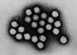 Adenovirus transmission electron micrograph B82-0142 lores.jpg