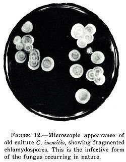 Coccidioides immitis microscopy.jpg