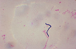 Streptococcus.jpg