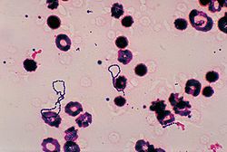 Streptococcus viridans PHIL 2897 lores.jpg