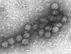 West Nile virus EM PHIL 2290 lores.jpg
