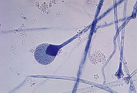 Mature sporangium of a Mucor sp. fungus.jpg