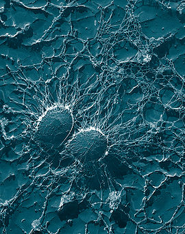 Staphylococcus aureus, 50,000x, USDA, ARS, EMU.jpg