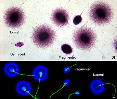 Imagen al microscopio óptico de espermatozoides sometidos a desnaturalización con una solución de lisis